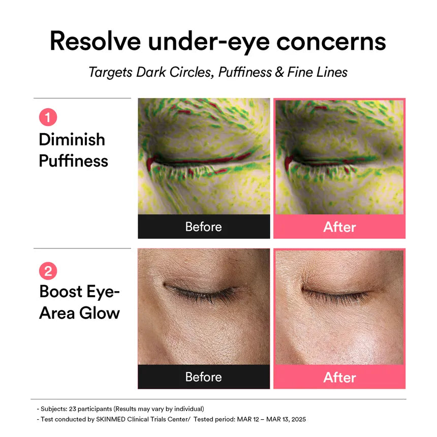 Abib PDRN Retinal Eye Patch Glow Jelly - Olive Kollection
