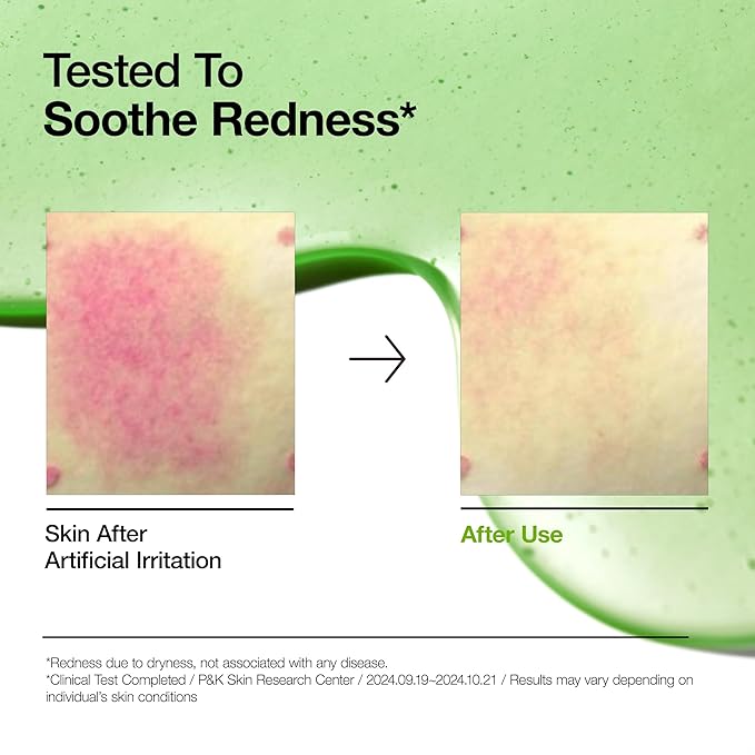 Anua Azelaic Acid 10 Hyaluron Redness Soothing Serum - Olive Kollection