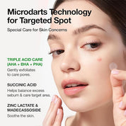 Anua Triple Acid Spot Care Microdart Patch - Olive Kollection