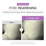 Eqqualberry Purple PDRN Pore Minimizing Serum - Olive Kollection