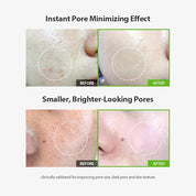 Sungboon Editor Green Tomato Pore Lifting Ampoule+ - Olive Kollection