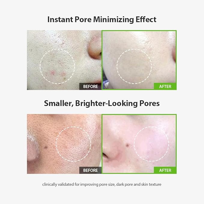 Sungboon Editor Green Tomato Pore Lifting Ampoule+ - Olive Kollection