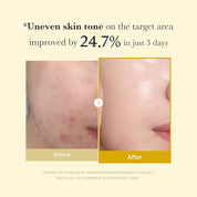 Medicube Kojic Acid Turmeric Night Wrapping Mask - Olive Kollection