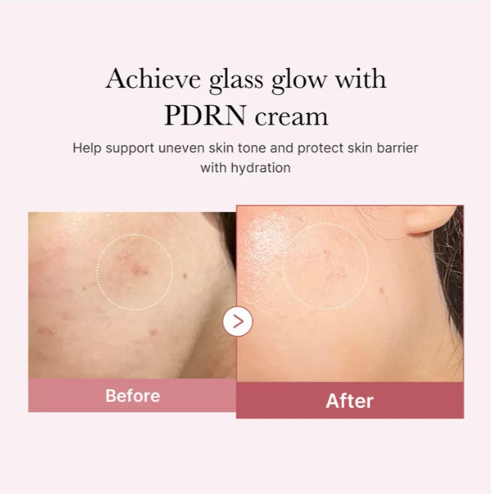 Medicube PDRN Pink Hyaluronic Moisturizing Cream - Olive Kollection