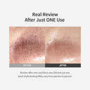 Sungboon Editor Blackhead Melting Clear Pad - Olive Kollection