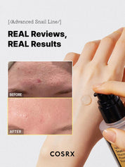 *Limited Time Deal* COSRX Advanced Snail 96 Mucin Power Essence - Olive Kollection