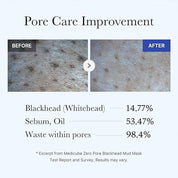 Medicube Zero Pore Blackhead Mud Mask - Olive Kollection