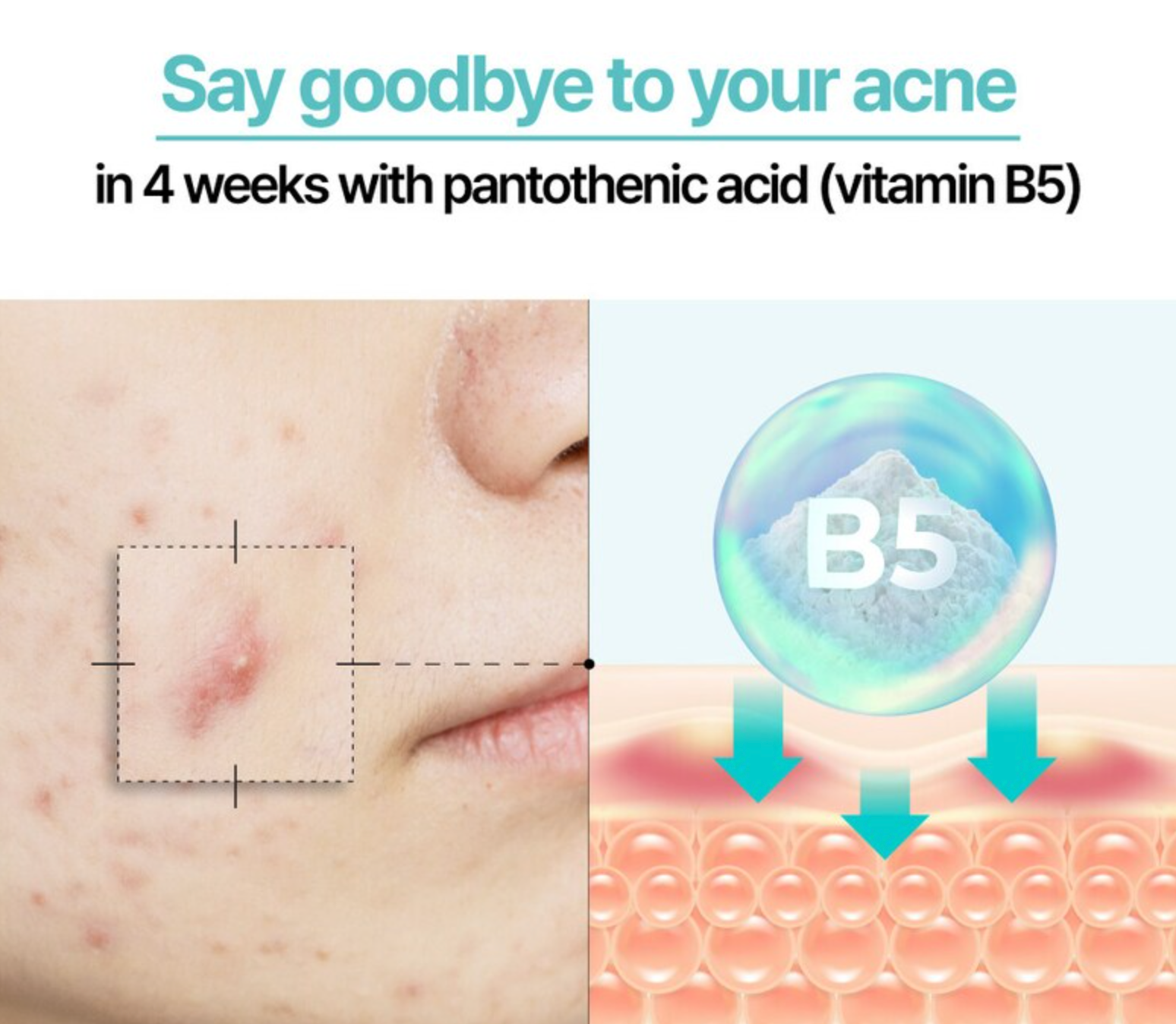 Numbuzin No.1 Pantothenic B5 Active Soothing Cream - Olive Kollection