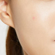 COSRX Acne Pimple Master Patch - Olive Kollection