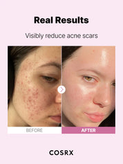 Cosrx The Niacinamide 15 Serum - Olive Kollection