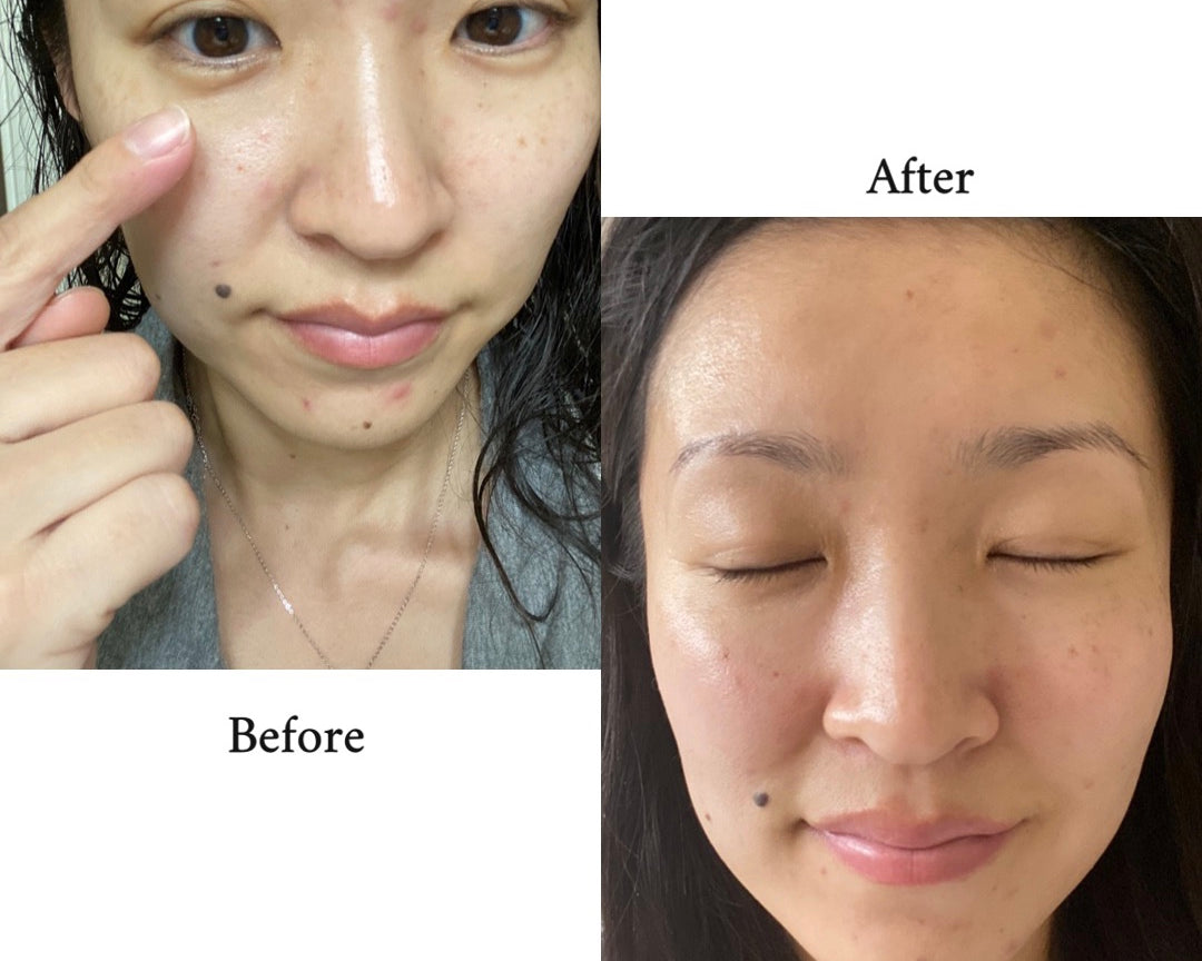 How I HEALED my damaged skin barrier with K-Beauty! - Olive Kollection