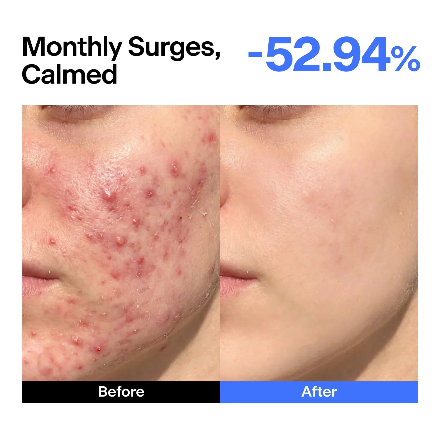THOME ABC Triple Synergy Redness Serum 30ml $28 – Korean Azelaic Acid has fragrance PM use Olive Kollection K-beauty since 2018