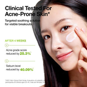 Anua Azelaic Acid Moisturizer CICA 7 Complex – centella extract leaf root Asiaticoside Asiatic Acid Madecassic Madecassoside full spectrum barrier