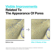 Anua BHA 2% Gentle Exfoliating Toner