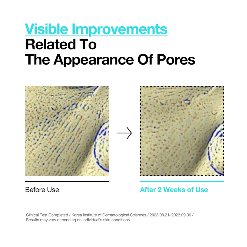 Anua BHA 2% Gentle Exfoliating Toner