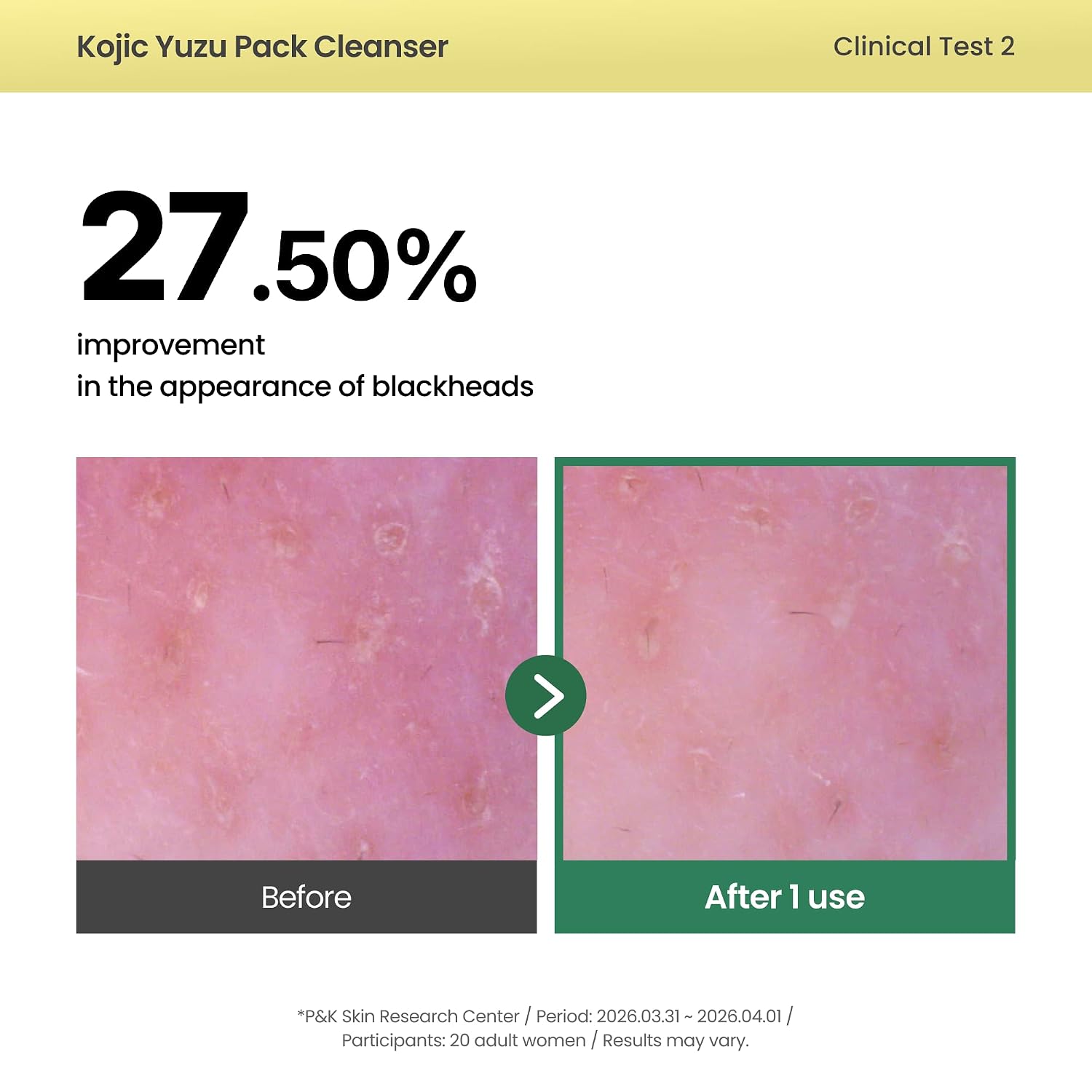 Axis-Y Kojic Yuzu Pack Cleanser – vegan Centella Panthenol Beta-Glucan 60g Korean brightening cleanser Olive Kollection