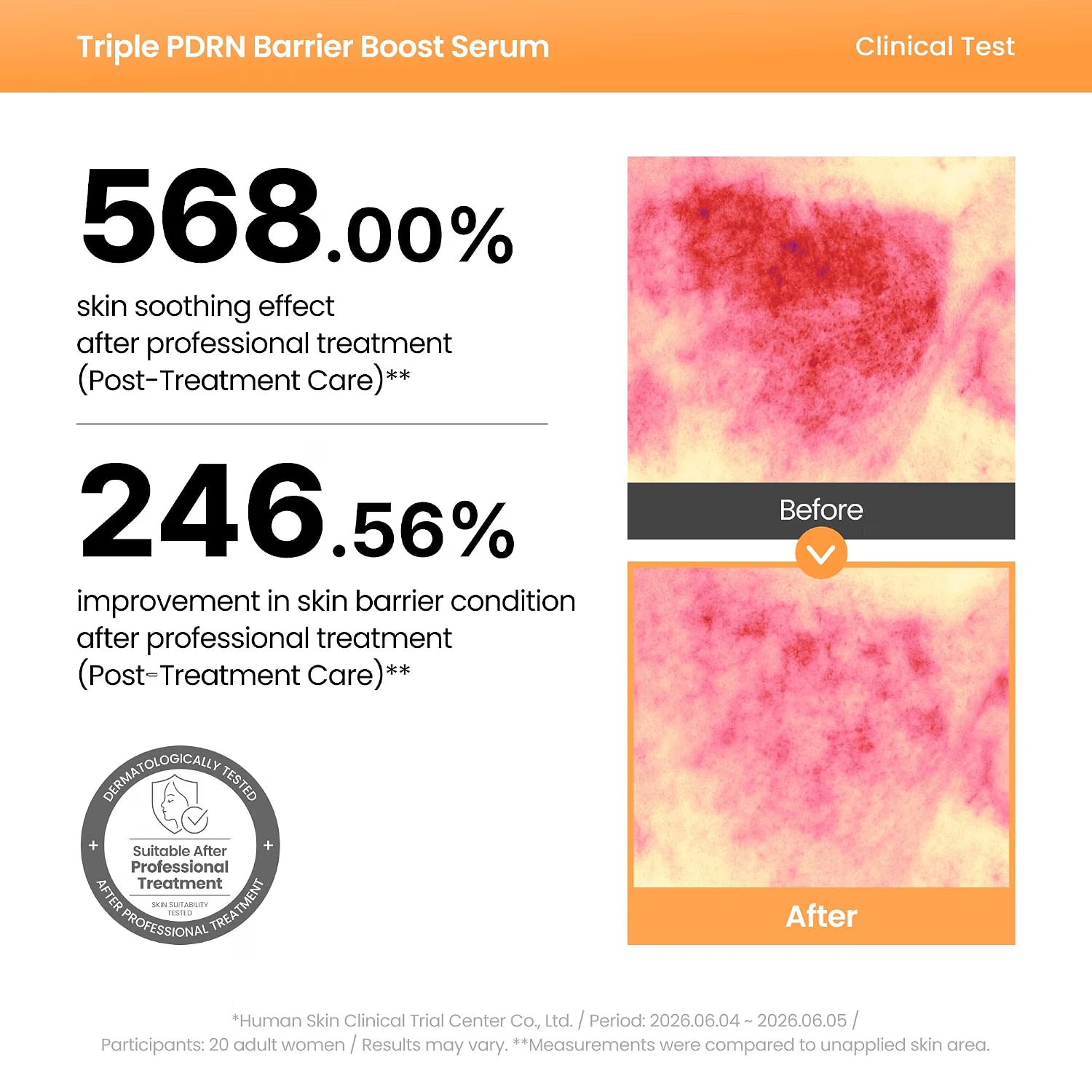 Axis-Y Triple PDRN Serum clinical barrier recovery results
