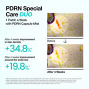 Anua PDRN Collagen Melting Patch wide-fit – covers nasolabial fold front cheeks jawline one patch smile lines nano-mesh film