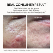 Arencia Eraser Shot Glycolic Acid Booster