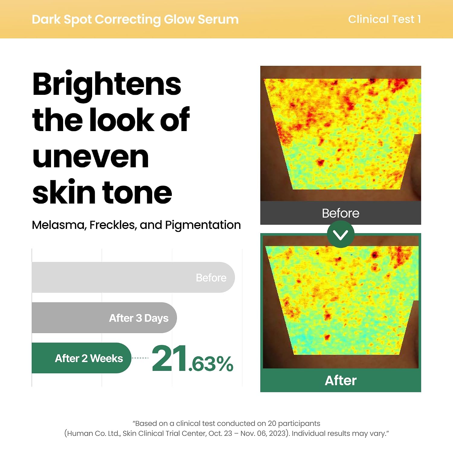 Axis-Y Dark Spot Serum clinical results 20% spot reduction 4 weeks