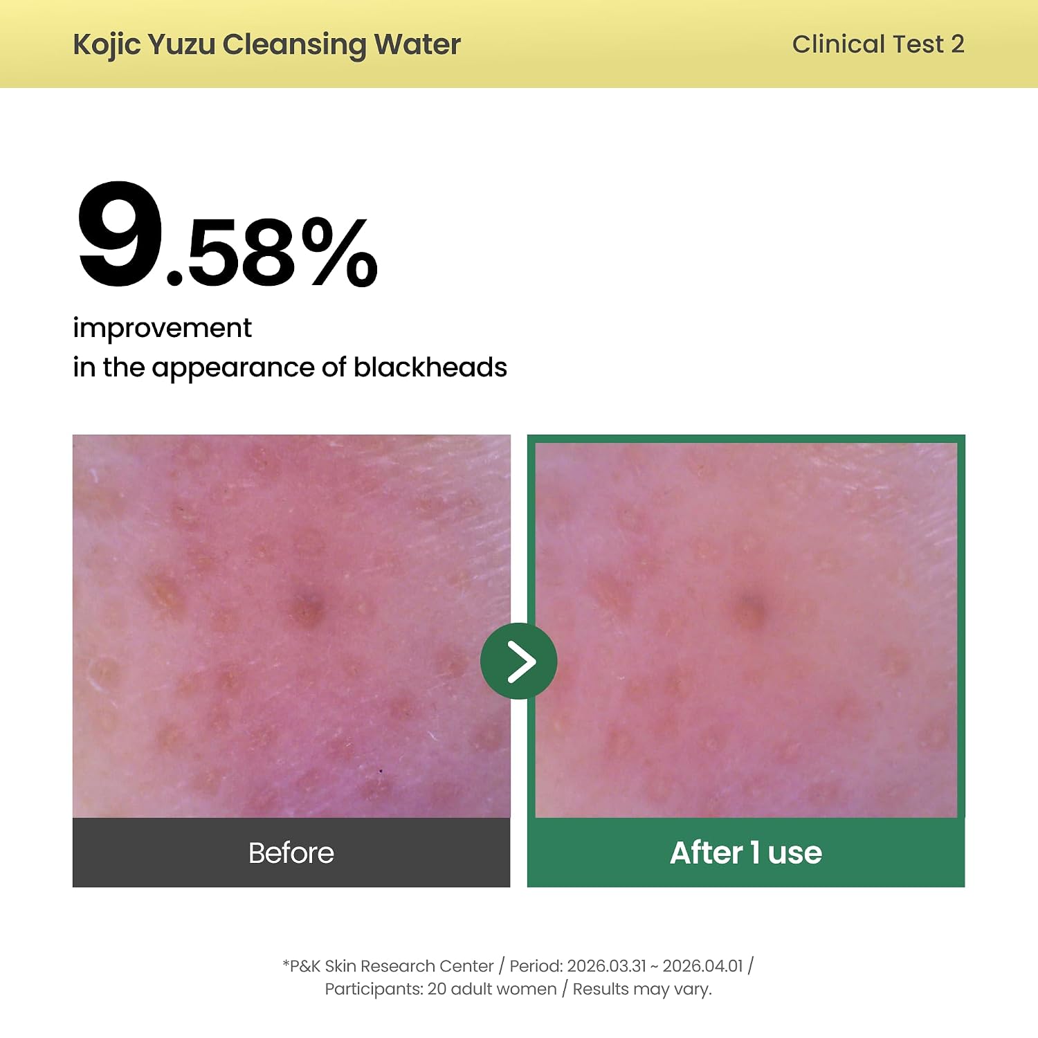 Axis-Y Cleansing Water calming botanicals – Centella Heartleaf Licorice Chamomile Green Tea Rosemary Korean vegan