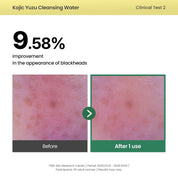 Axis-Y Cleansing Water calming botanicals – Centella Heartleaf Licorice Chamomile Green Tea Rosemary Korean vegan