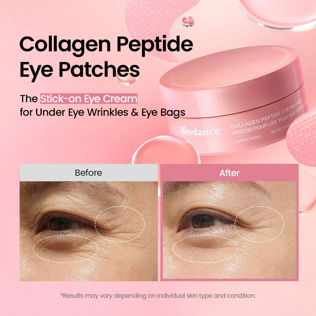 
Biodance Collagen Eye Patch Probiotic Exosomes 10 peptides – Lactobacillus Ferment Acetyl Hexapeptide EGF IGF collagen synthesis firming