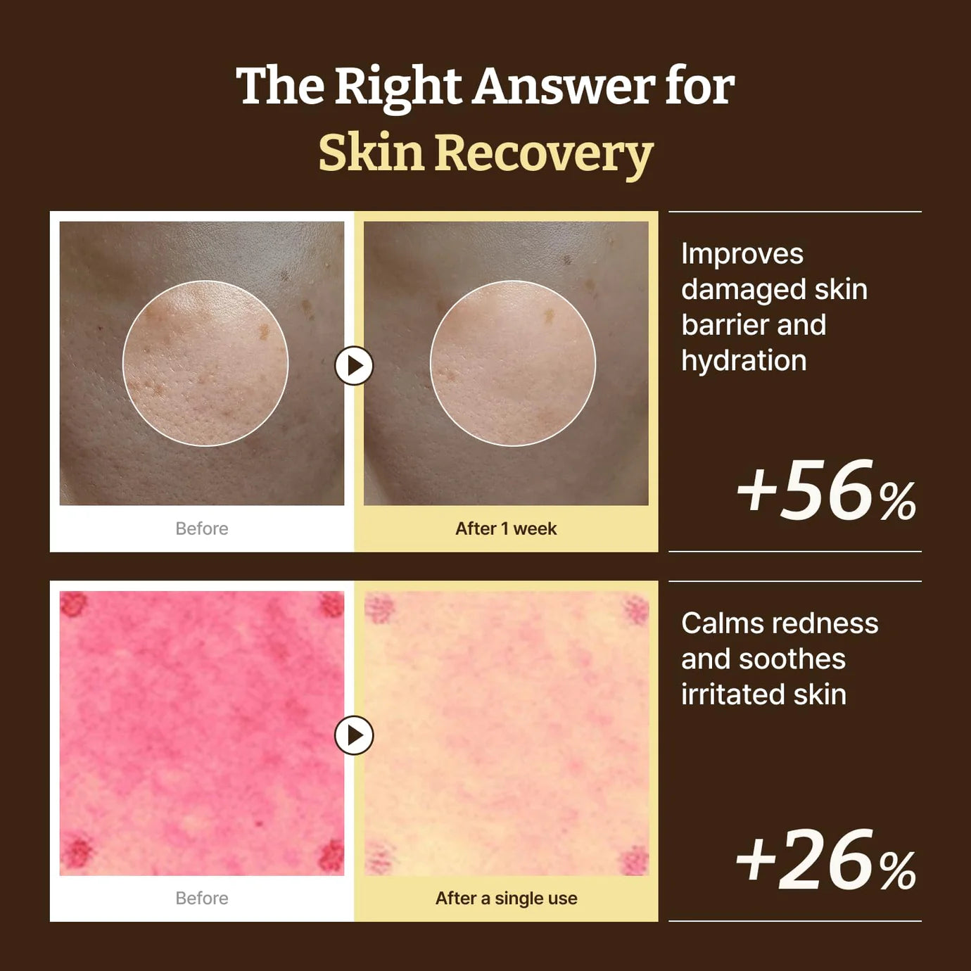 Dr. Reju-All Advanced PDRN Relief Cream 20 ml