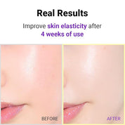 Isntree Hyper Retinol EX 1.0 Serum - Olive Kollection