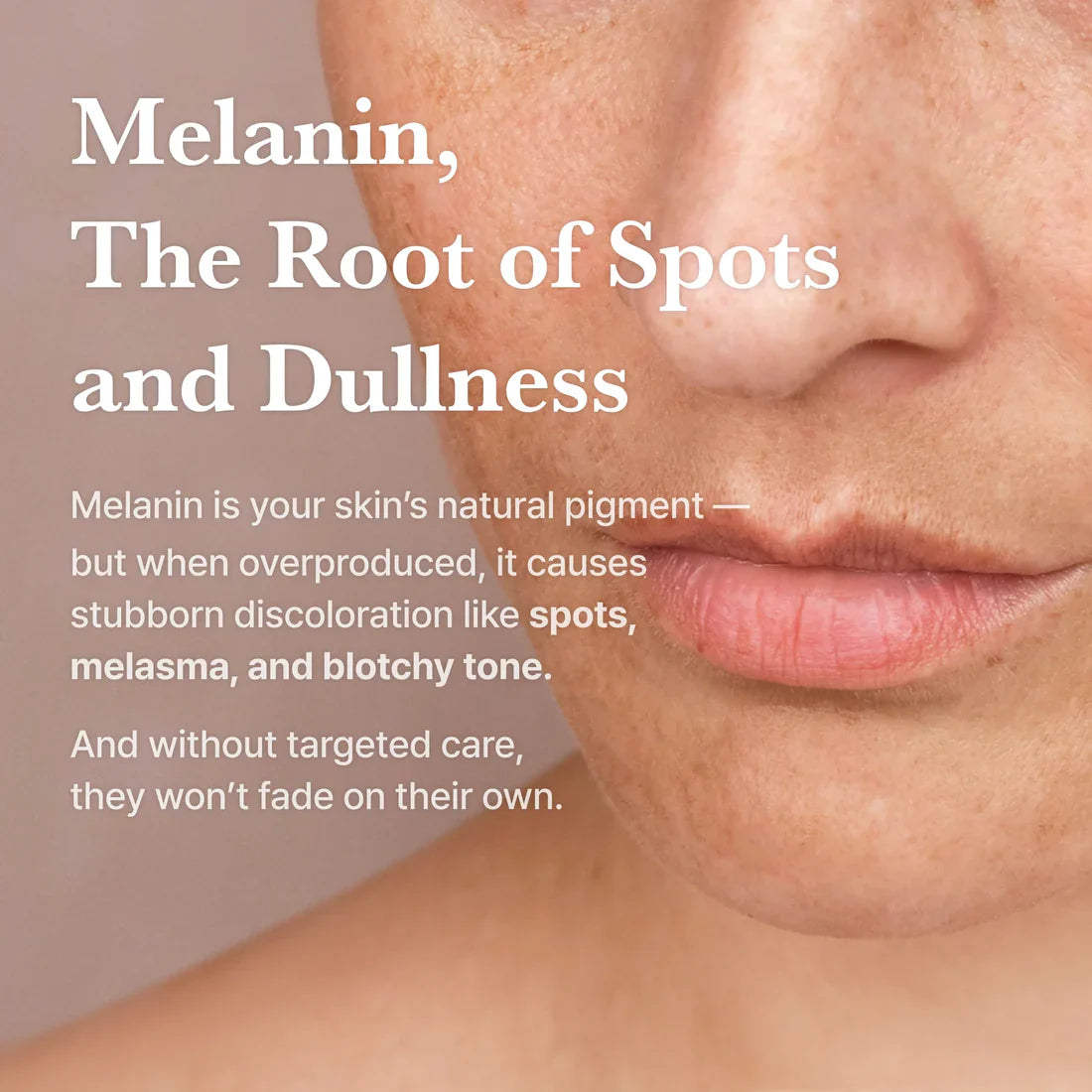 I'm From Apricot Dark Spot Ampoule Vitamin C – ascorbic acid ascorbyl glucoside beta-carotene acetyl glucosamine 4 brightening pathways
