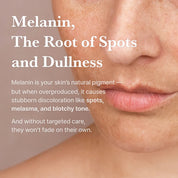 I'm From Apricot Dark Spot Ampoule Vitamin C – ascorbic acid ascorbyl glucoside beta-carotene acetyl glucosamine 4 brightening pathways