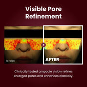 Kopher Curepair Ampoule 10GF EGF complex – 10 Nobel Prize growth factor types Korean pore tightening barrier repair
