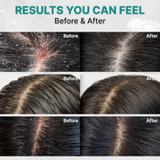 Lilyeve Scalp:Turn Cica PDRN Deep Clean Shampoo 500g
