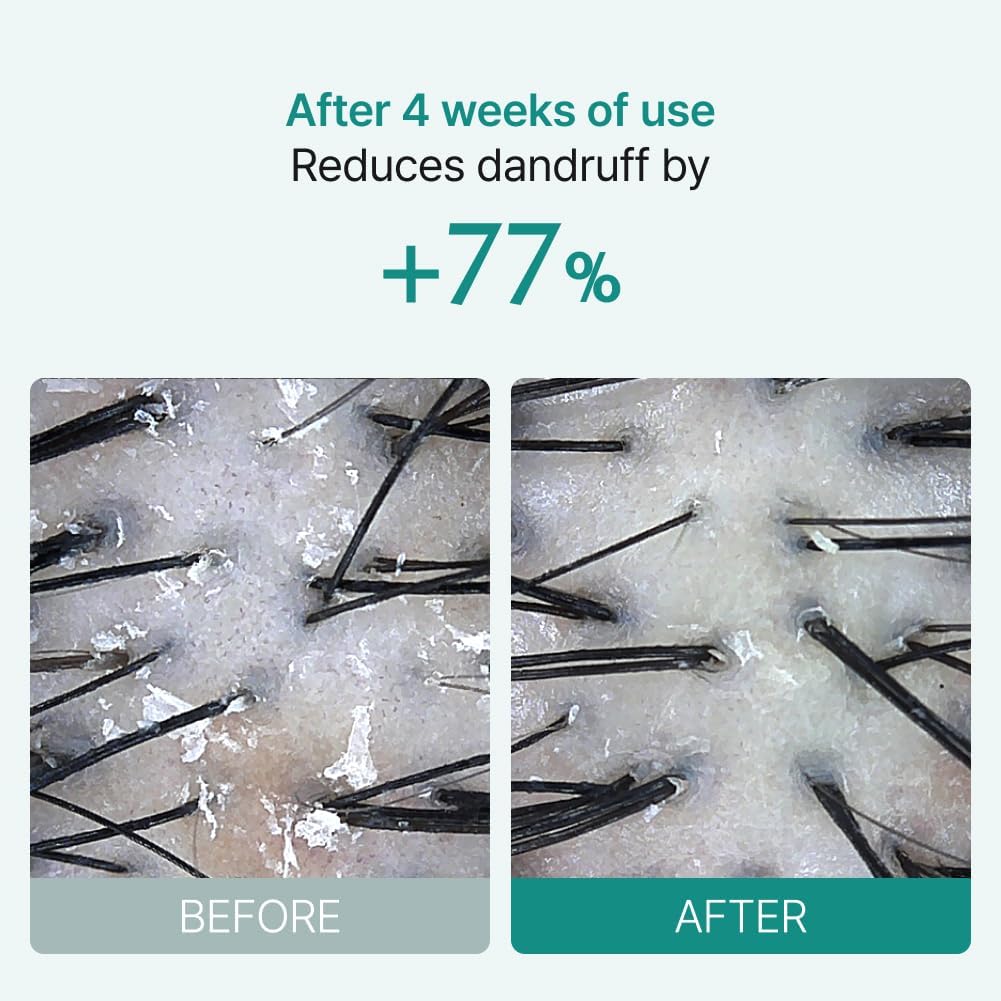 Lilyeve Scalp: Turn Cica PDRN Brush Ampoule