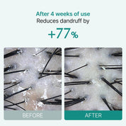 Lilyeve Scalp: Turn Cica PDRN Brush Ampoule