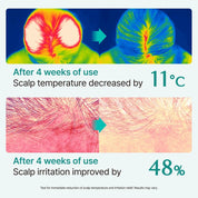 Lilyeve Scalp: Turn Cica PDRN Brush Ampoule