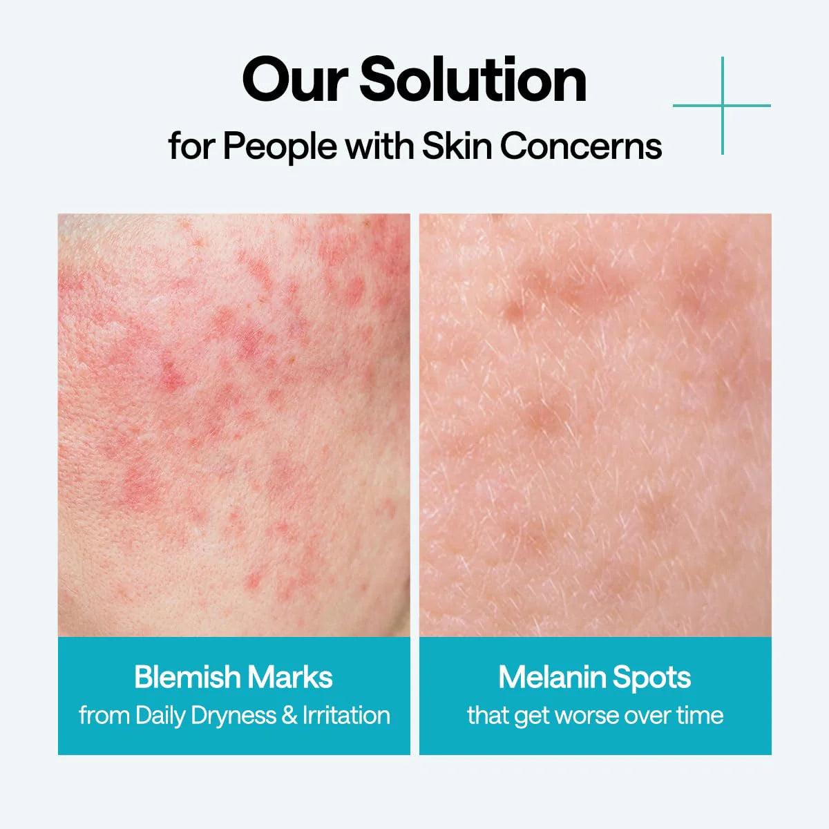 Mediheal Madecassoside Wrapping Serum Mask Blemish Repair - Olive Kollection