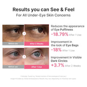 Medicube Eye Patch PDRN Caffeine Collagen 60pcs $22 – fragrance-free Korean anti-aging eye patch 30 pairs Olive Kollection K-beauty gift