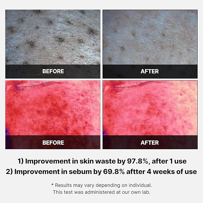 Medicube Red Succinic Acid Peeling Pad (70ea) - Olive Kollection