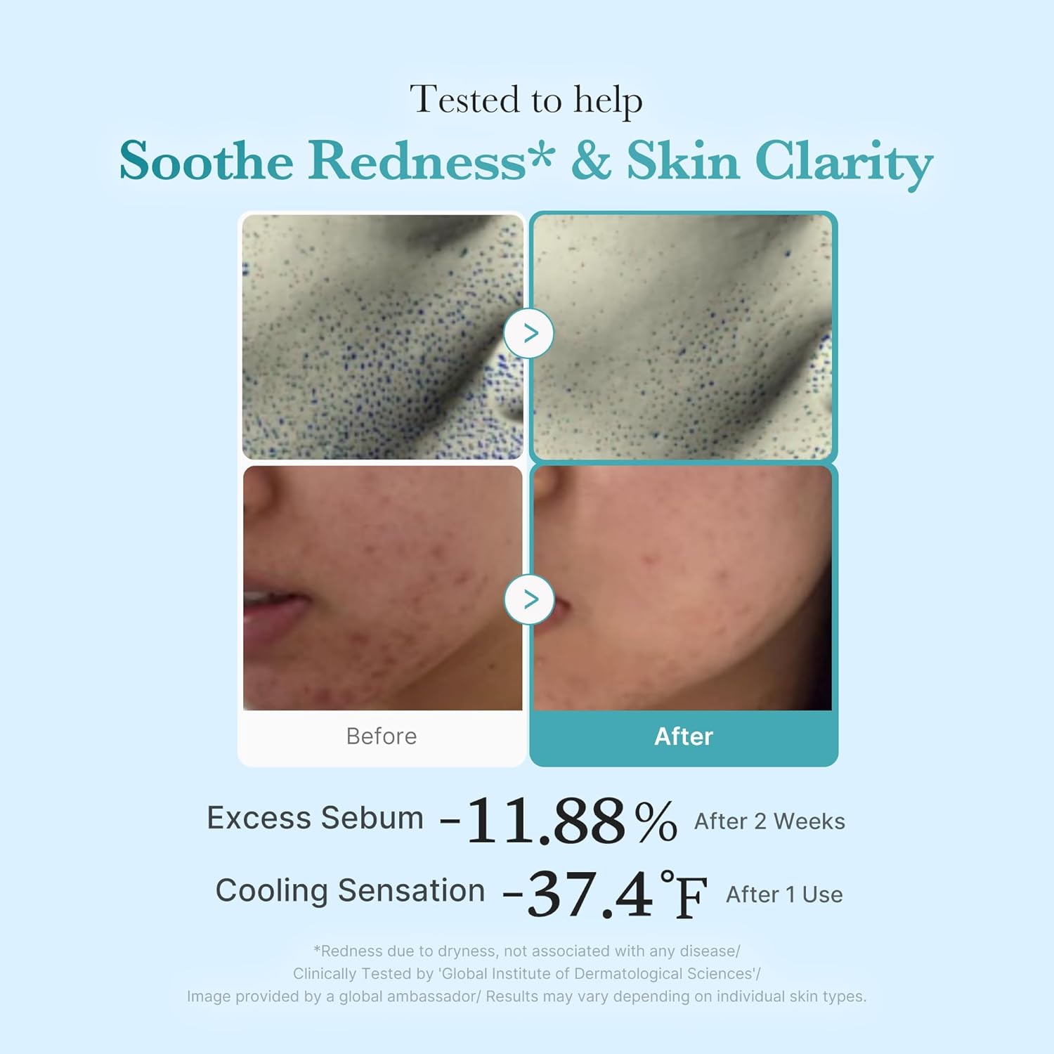 Medicube Azelaic Acid Niacinamide Clear Toner 250ml