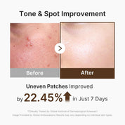 Medicube Deep Vita C Cream on skin – visible brightening dark spot fading radiant glow customizable capsule gel ratio Korean