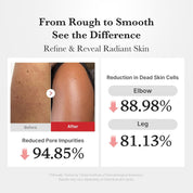 Medicube Body Peel Shot target areas – ingrown hairs chicken skin strawberry skin rough bumpy body texture Korean bodycare