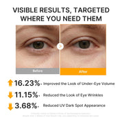 Medicube Kojic Acid Turmeric Retinal Eye & Face Patches