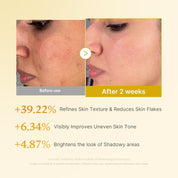 Medicube Kojic Acid Turmeric Smoothing Toner - Olive Kollection