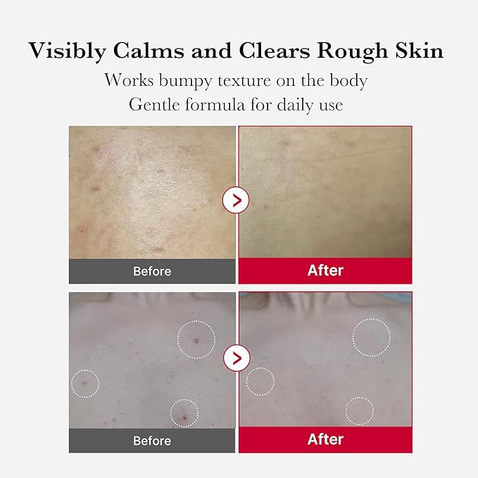 Medicube Red Body Peeling Shot - Olive Kollection