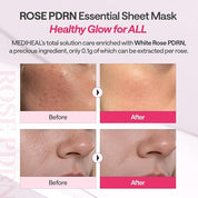 Mediheal Rose PDRN Essential Sheet Mask - Olive Kollection
