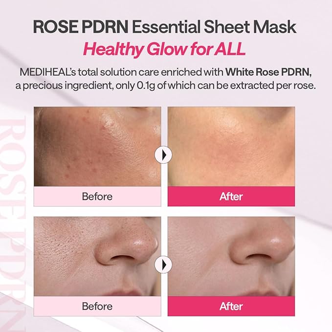 Mediheal Rose PDRN Essential Sheet Mask - Olive Kollection
