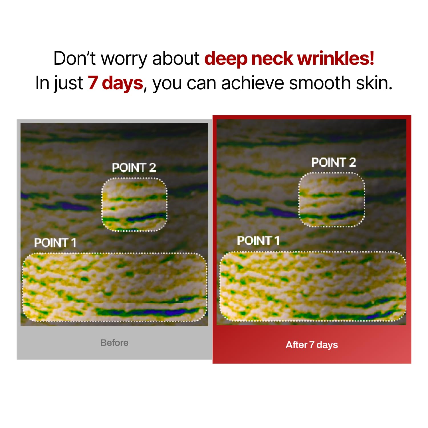 Meditherapy Wrinkle-Fit Neck Mask Set - Olive Kollection