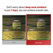 Meditherapy Wrinkle-Fit Neck Mask Set - Olive Kollection