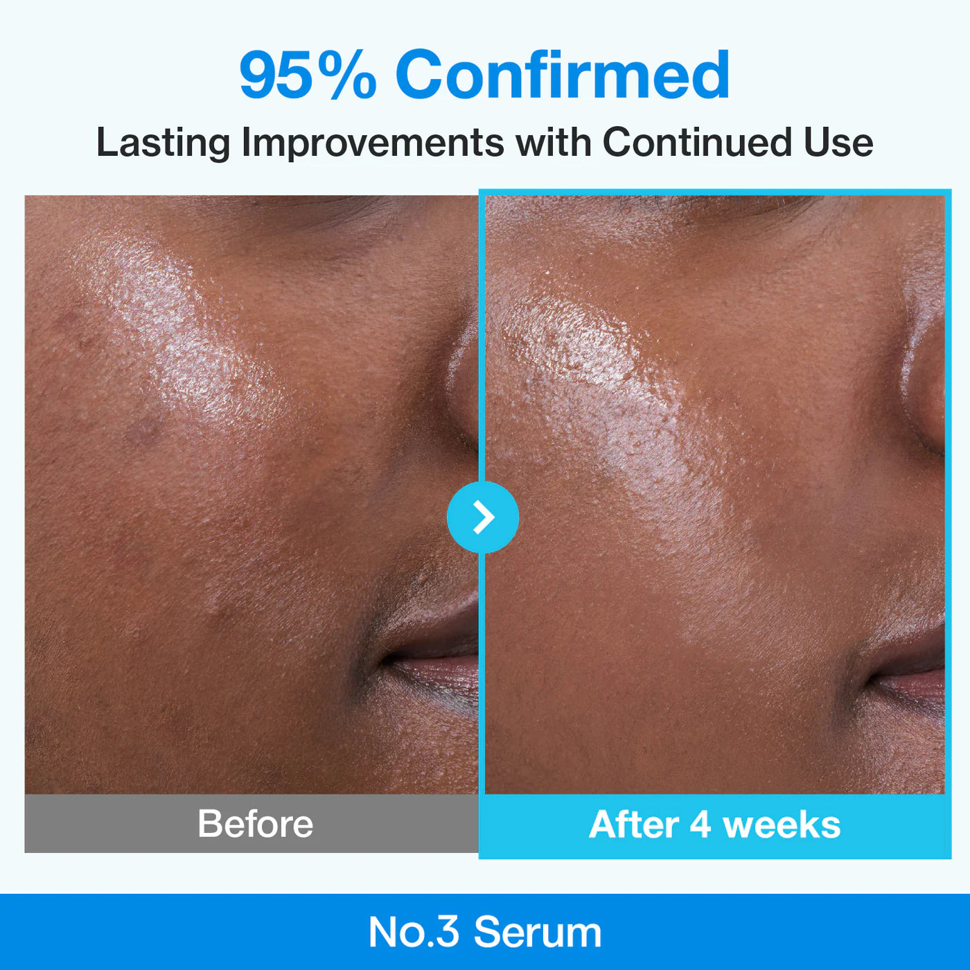 Numbuzin No.3 Blue Bio-Retinol Pore Serum – Korean Retinol for